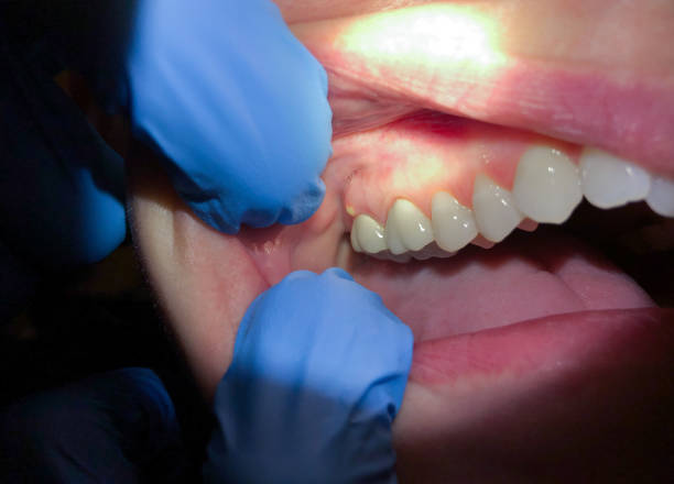Best Broken or Cracked Tooth Emergency Dentist in Colonial Beach, VA