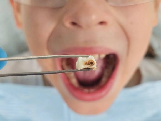 Best Weekend Emergency Dentist in Colonial Beach, VA